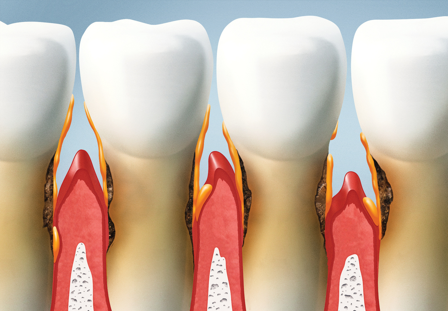 teeth and gums, tooth and gum